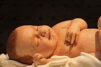 哪些医院可以进行第二代试管婴儿技术？