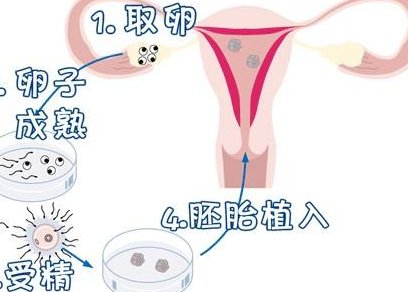 试管移植成功的十个征兆？我没有征兆就是不成功？